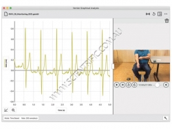 GA-Pro_Monitoring-EKG.jpg